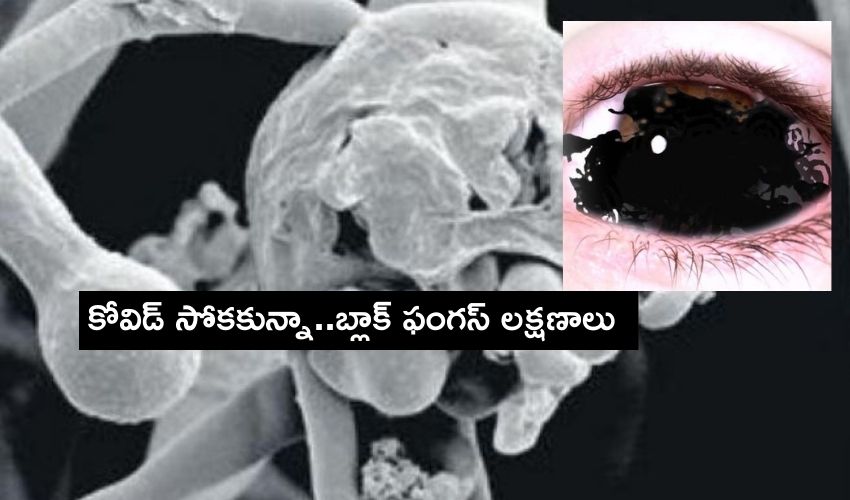 CM Jagan : కోవిడ్ సోకని 40మందిలో బ్లాక్ ఫంగస్ గుర్తింపు CM Jagan : కోవిడ్ సోకని 40మందిలో బ్లాక్ ఫంగస్ గుర్తింపు