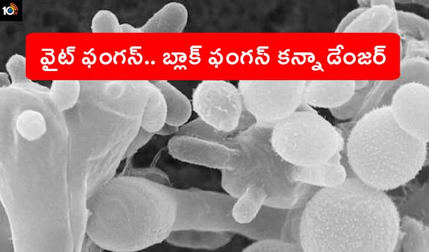 White Fungus : మరో ముప్పు… వైట్ ఫంగస్.. ఇది బ్లాక్ ఫంగస్ కంటే డేంజర్.. వీరికే ఎక్కువ వస్తుందట… White Fungus : మరో ముప్పు… వైట్ ఫంగస్.. ఇది బ్లాక్ ఫంగస్ కంటే డేంజర్.. వీరికే ఎక్కువ వస్తుందట…