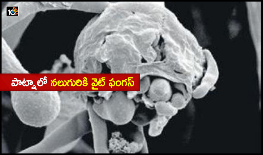 Patna White Fungus