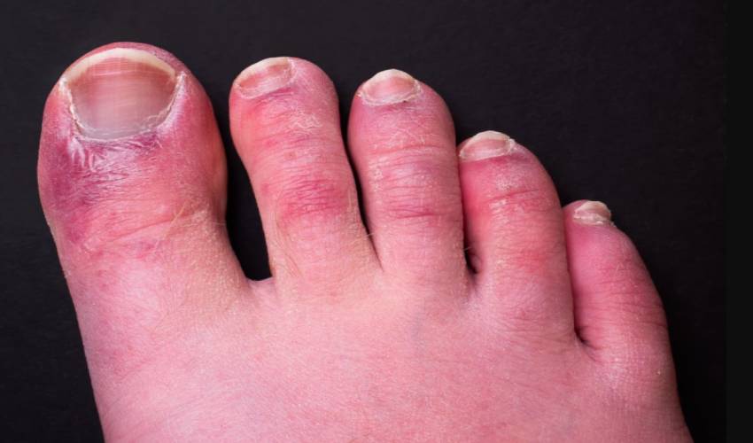21 Different Covid Symptoms And Most Common Just Feel Like A Cold, Expert Warns (1)