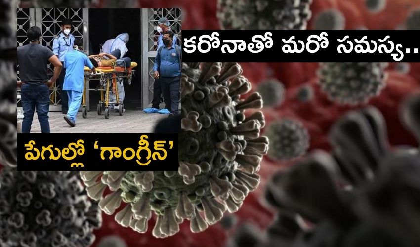 Gangrene : కరోనాతో పేగుల్లో ‘గాంగ్రీన్’..ముంబైలో 12, గుజరాత్ లో 100 కేసులు Gangrene : కరోనాతో పేగుల్లో ‘గాంగ్రీన్’..ముంబైలో 12, గుజరాత్ లో 100 కేసులు