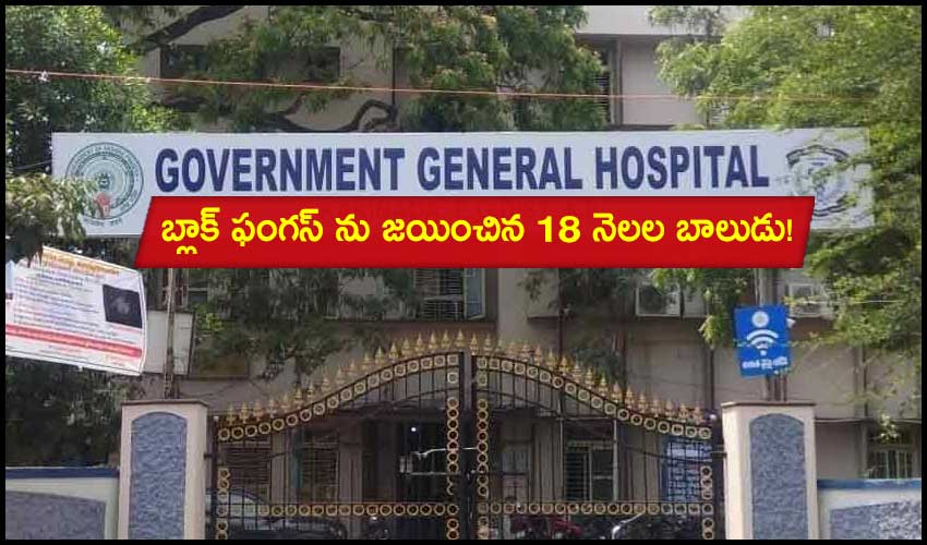 Kakinada GGH: బ్లాక్ ఫంగస్ ను జయించిన 18 నెలల బాలుడు! Kakinada GGH: బ్లాక్ ఫంగస్ ను జయించిన 18 నెలల బాలుడు!