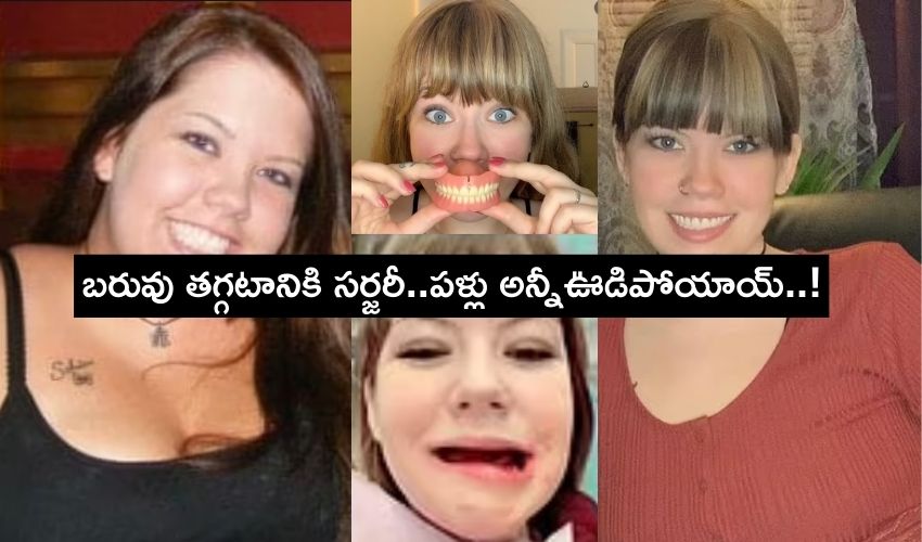 Woman Facing Teeth Complications After Gastric Bypass.. (2)