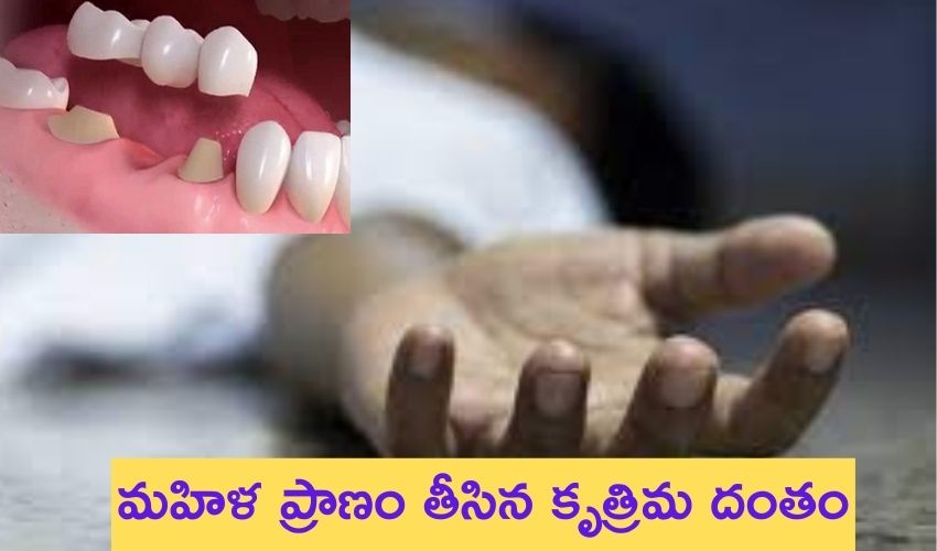 మహిళ ప్రాణం తీసిన కృత్రిమ దంతం