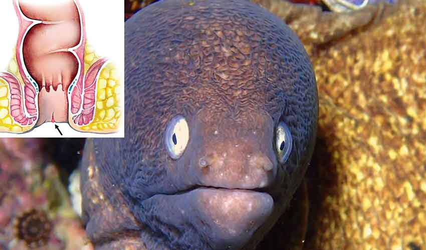 Eel Fish Anus : వీడెవడండీ బాబూ.. మలద్వారంలోకి చేపను పంపి ప్రాణాల మీదకు తెచ్చుకున్నాడు Eel Fish Anus : వీడెవడండీ బాబూ.. మలద్వారంలోకి చేపను పంపి ప్రాణాల మీదకు తెచ్చుకున్నాడు