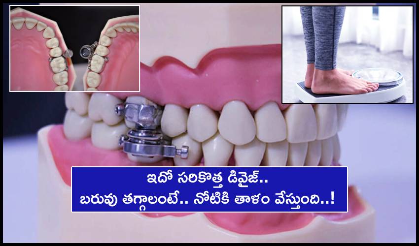 Weight-Loss Device : ఇదో సరికొత్త డివైజ్.. బరువు తగ్గాలంటే.. నోటికి తాళం వేస్తుంది..! Weight-Loss Device : ఇదో సరికొత్త డివైజ్.. బరువు తగ్గాలంటే.. నోటికి తాళం వేస్తుంది..!