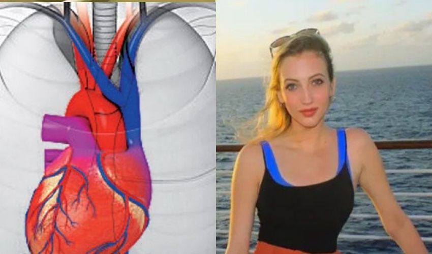 Dextrocardia : దగ్గుతో ఆసుపత్రికి వెళితే…అసలు విషయం చెప్పిన వైద్యులు…ఆశ్ఛర్యపోయిన మహిళ Dextrocardia : దగ్గుతో ఆసుపత్రికి వెళితే…అసలు విషయం చెప్పిన వైద్యులు…ఆశ్ఛర్యపోయిన మహిళ