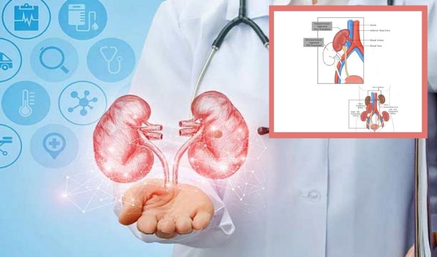 5 Kidneys Man : ఒక వ్యక్తిలో ఐదు కిడ్నీలు.. రెండు సొంతానివి.. మరో మూడు..? 5 Kidneys Man : ఒక వ్యక్తిలో ఐదు కిడ్నీలు.. రెండు సొంతానివి.. మరో మూడు..?