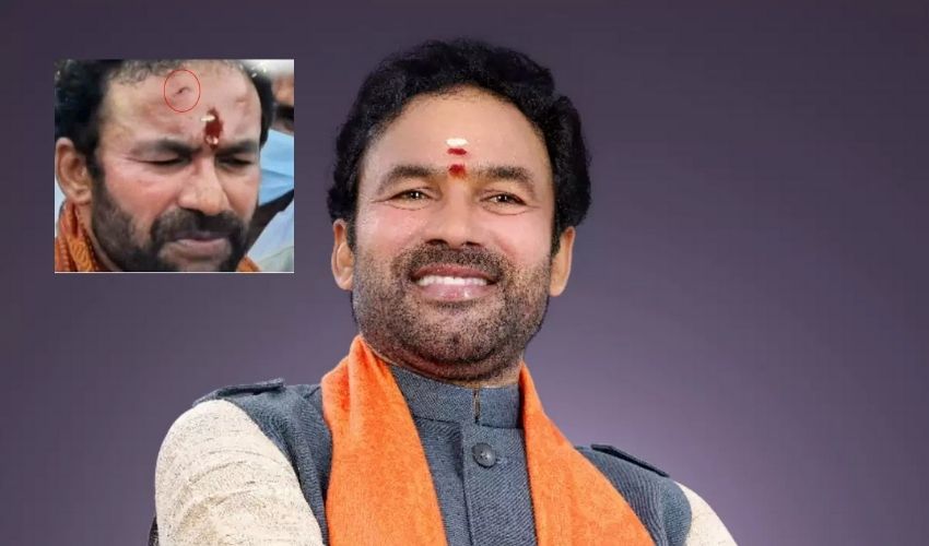 Kishan Reddy: కేంద్రమంత్రి కిషన్ రెడ్డి తలకు గాయం Kishan Reddy: కేంద్రమంత్రి కిషన్ రెడ్డి తలకు గాయం