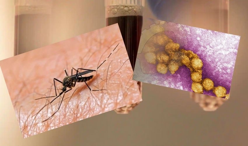 West Nile Virus