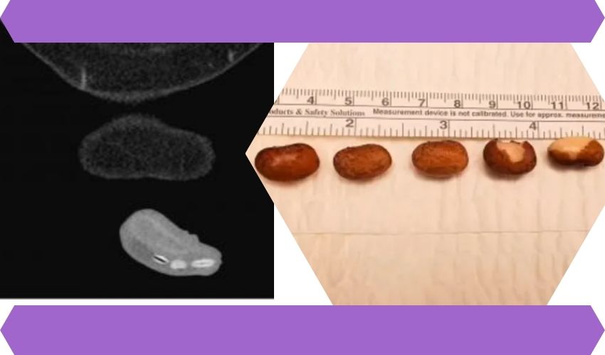Kidney Beens
