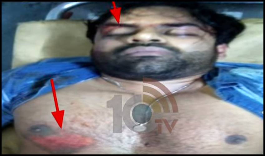 Hero Sai Dharam Tej Inured In Road Accident