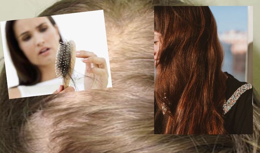 Hair Loss Treatment Drug : బట్టతల మహిళలకు శుభవార్త..నివారణకు మెడిసిన్ వచ్చేసింది.. Hair Loss Treatment Drug : బట్టతల మహిళలకు శుభవార్త..నివారణకు మెడిసిన్ వచ్చేసింది..