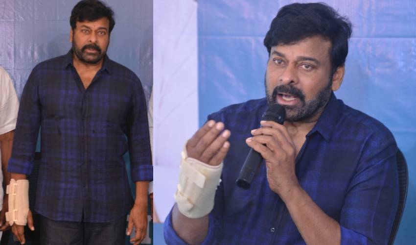 Chiranjeevi : చిరంజీవి చేతికి గాయం Chiranjeevi : చిరంజీవి చేతికి గాయం