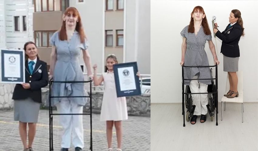 World's Tallest Living Woman Rumeysa Gelgi