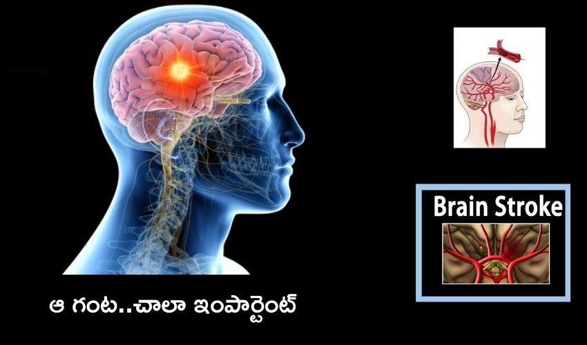 Braine Stock
