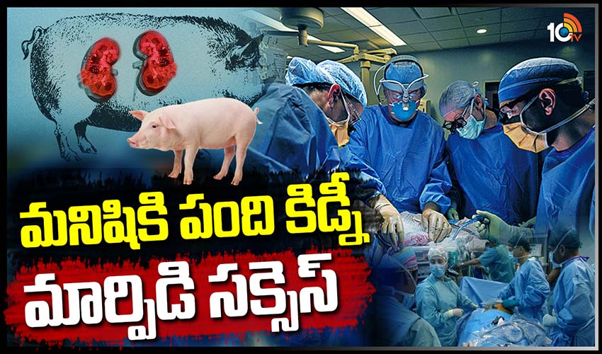 మనిషికి పంది కిడ్నీ మార్పిడి సక్సెస్