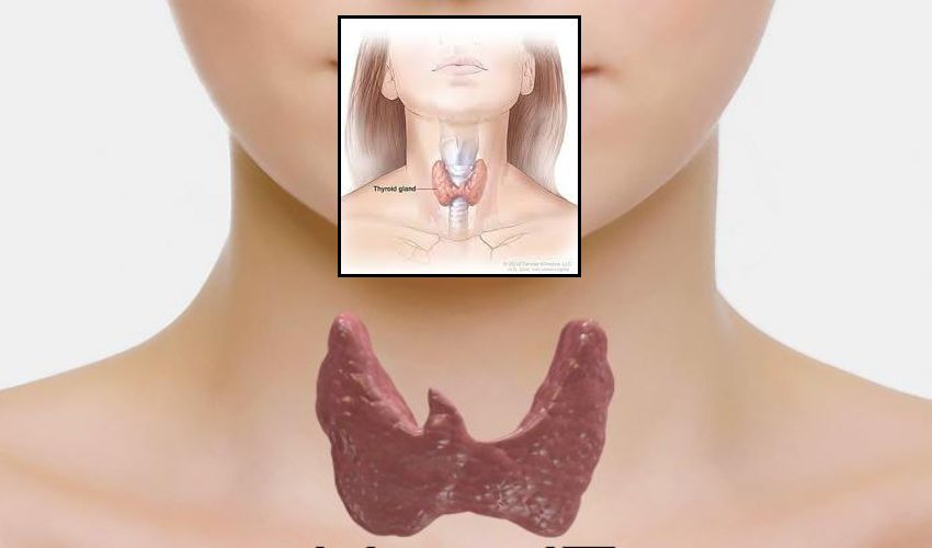 thyroid : థైరాయిడ్ సమస్య ప్రమాదకరమేనా?… thyroid : థైరాయిడ్ సమస్య ప్రమాదకరమేనా?…