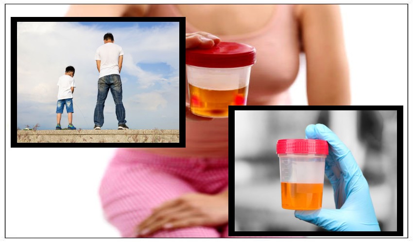 Urine Color : మూత్రం రంగుతో వ్యాధి నిర్ధారణ ఎలాగో తెలుసా?.. Urine Color : మూత్రం రంగుతో వ్యాధి నిర్ధారణ ఎలాగో తెలుసా?..