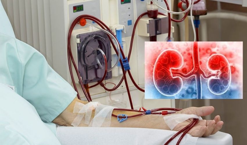 Free Dialysis For Kidney Patients