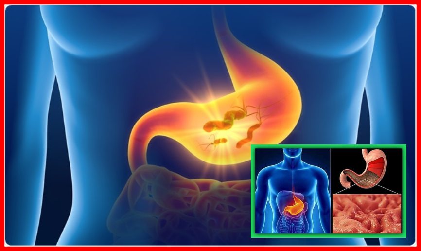 acidity drugs : అసిడిటీ మందులు దీర్ఘకాలం వాడొచ్చా!… acidity drugs : అసిడిటీ మందులు దీర్ఘకాలం వాడొచ్చా!…