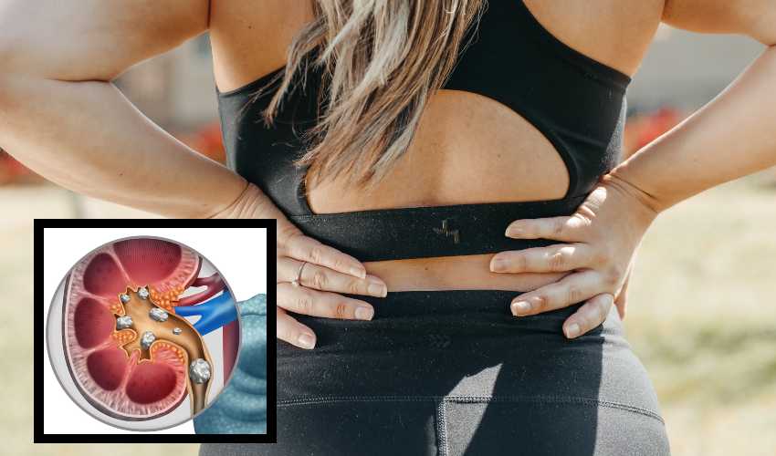 Kidney Stones : కిడ్నీలో రాళ్ళను కరిగించే చిట్కాలు Kidney Stones : కిడ్నీలో రాళ్ళను కరిగించే చిట్కాలు