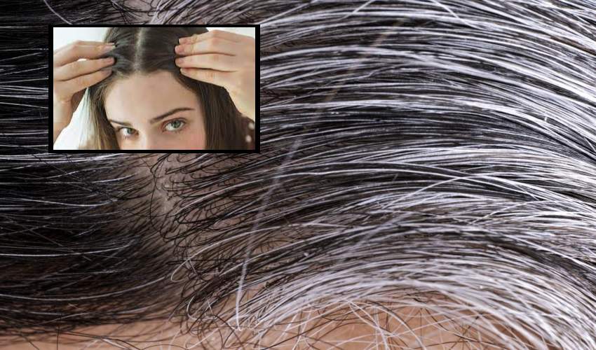 White Gray Hairs
