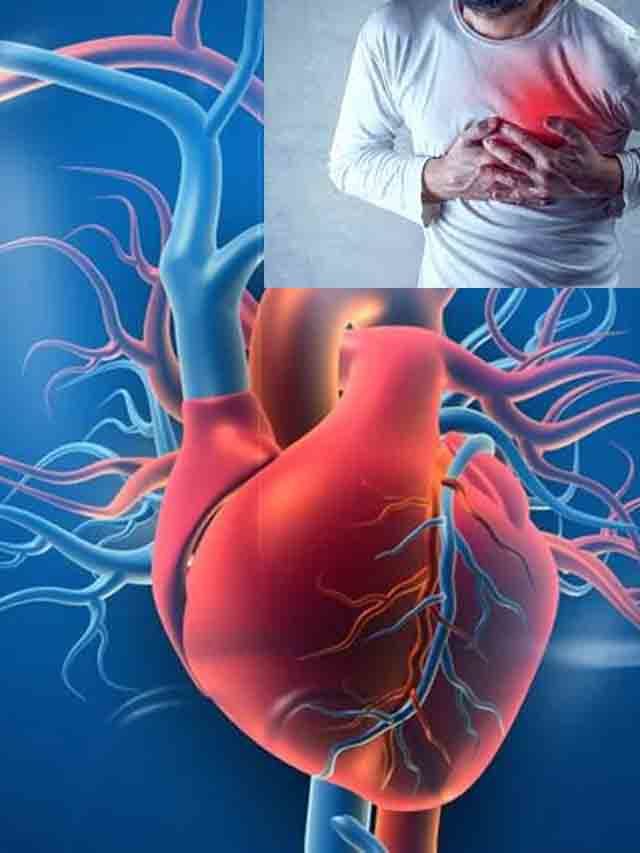>గుండె జబ్బులు రాకుండా ఉండాలంటే..!