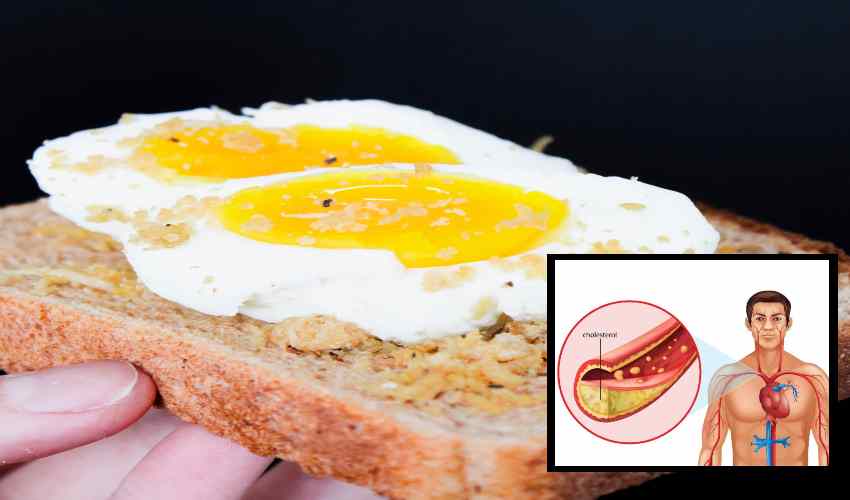 Bad Cholesterol