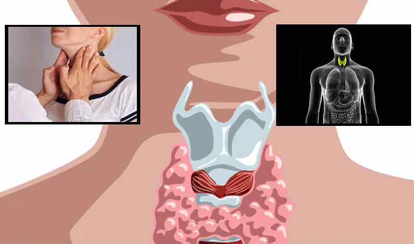 Thyroid : ఈ లక్షణాలు ఉంటే….థైరాయిడ్ కావచ్చు Thyroid : ఈ లక్షణాలు ఉంటే….థైరాయిడ్ కావచ్చు
