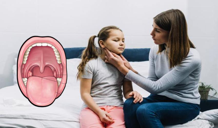 Tonsillitis : టాన్సిల్స్ సమస్యకు కారణాలు తెలుసా?.. Tonsillitis : టాన్సిల్స్ సమస్యకు కారణాలు తెలుసా?..