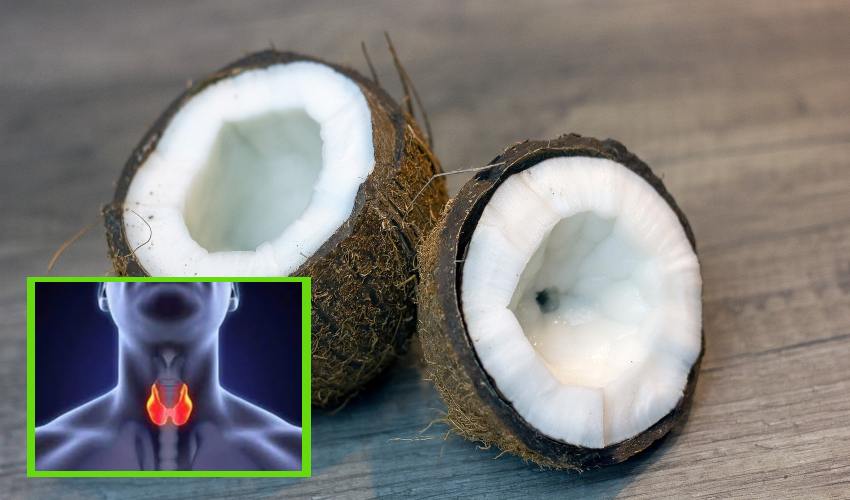 Thyroid : థైరాయిడ్ ఆరోగ్యానికి కొబ్బరితో మేలు Thyroid : థైరాయిడ్ ఆరోగ్యానికి కొబ్బరితో మేలు