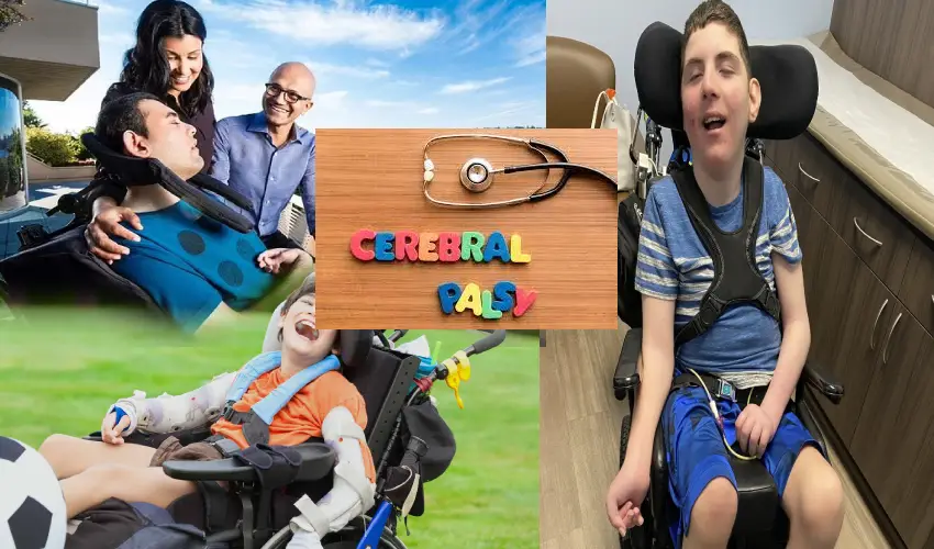 Cerebral palsy Disease : ప్రపంచవ్యాప్తంగా 1.7 కోట్ల మంది సెరిబ్రల్ పాల్సీ బాధితులు..భారత్లో 25లక్షల మంది Cerebral palsy Disease : ప్రపంచవ్యాప్తంగా 1.7 కోట్ల మంది సెరిబ్రల్ పాల్సీ బాధితులు..భారత్లో 25లక్షల మంది