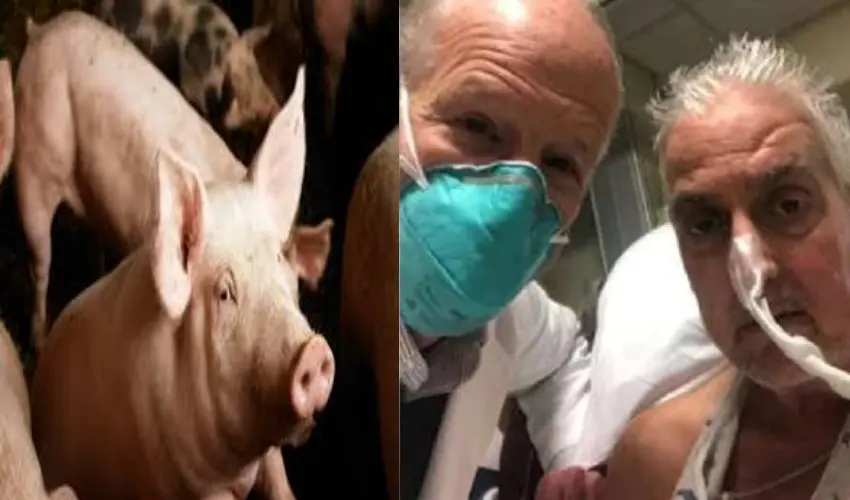 David Bennett First Person To Receive Gene Edited Pig Heart Dies Two Months After Historic Transplant (1)