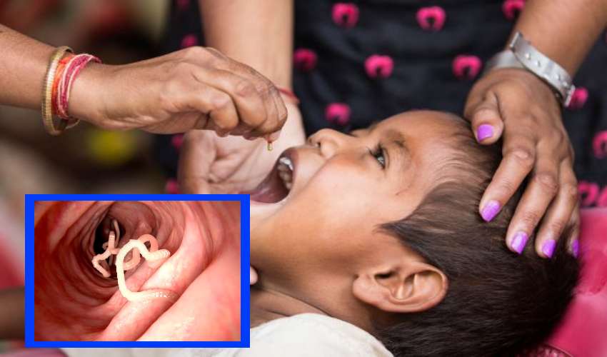 Worms : నులిపురుగులతో చిన్నారుల ఆరోగ్యానికి ముప్పు!… Worms : నులిపురుగులతో చిన్నారుల ఆరోగ్యానికి ముప్పు!…