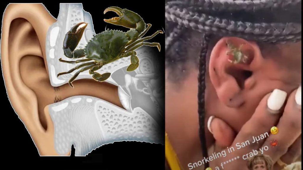 Crab In Ear
