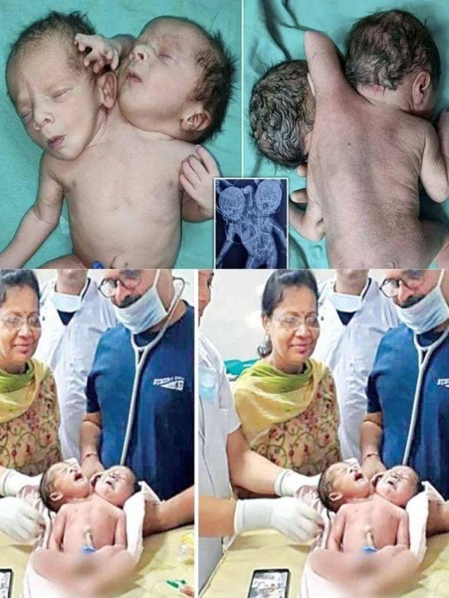 >వింత శిశువు జననం