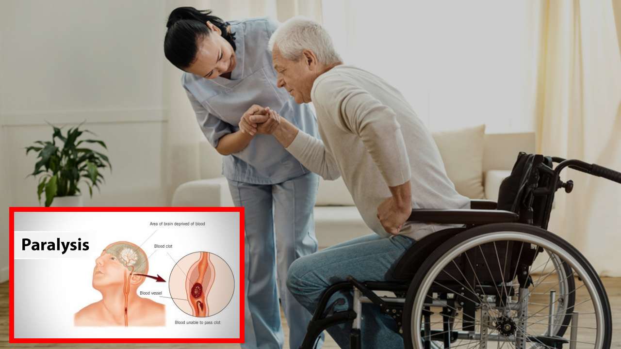 Paralysis : పక్షవాతానికి అధిక బరువు, మధుమేహం కారణమా? Paralysis : పక్షవాతానికి అధిక బరువు, మధుమేహం కారణమా?