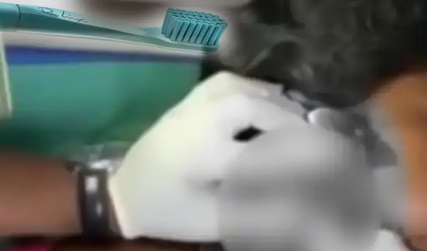 Toothbrush Got Stuck In Women Mouth After She Fell