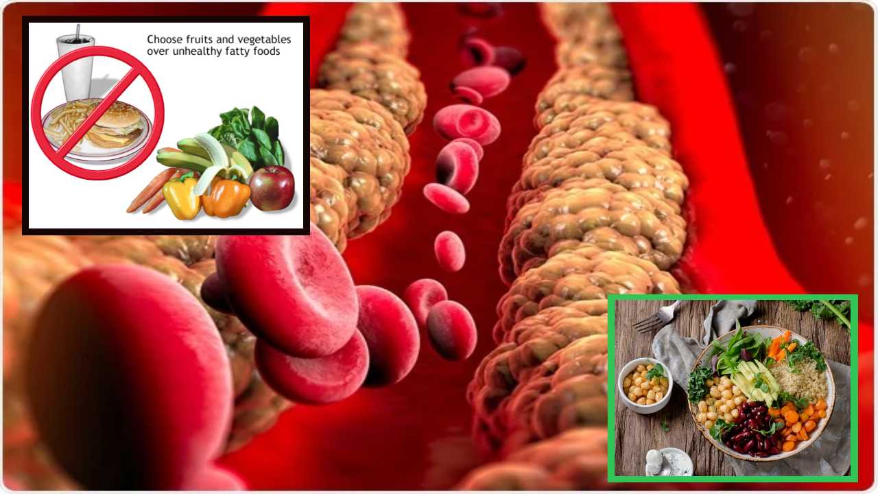 Triglycerides : ట్రైగ్లిజెరైడ్ల అధిక స్ధాయి శరీరానికి హాని కరమా?… Triglycerides : ట్రైగ్లిజెరైడ్ల అధిక స్ధాయి శరీరానికి హాని కరమా?…