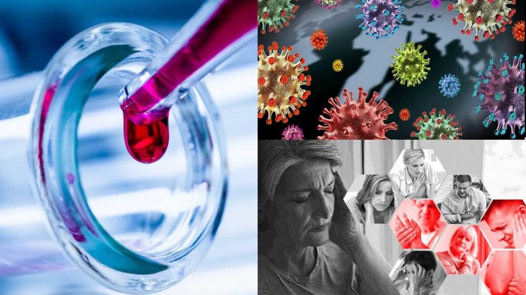 Coronavirus Us Study Finds 30% Covid Patients Develop 'long Covid'