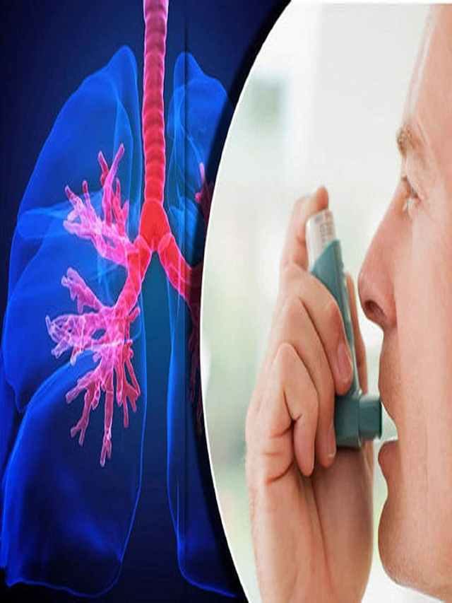 >ఆస్తమా రోగులు తినాల్సిన పండ్లు, కూరగాయలు..