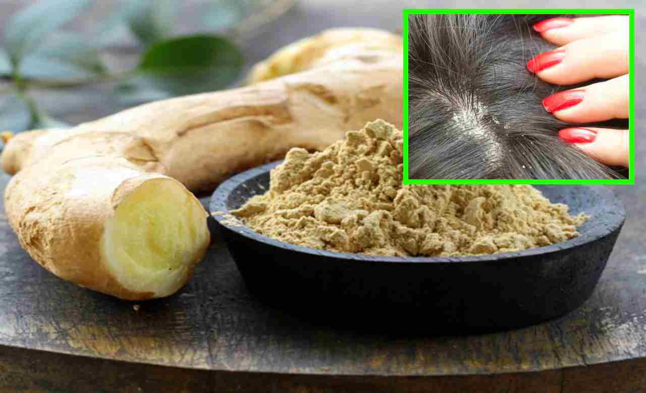Dandruff : చుండ్రు సమస్యకు అల్లంతో చికిత్స! Dandruff : చుండ్రు సమస్యకు అల్లంతో చికిత్స!