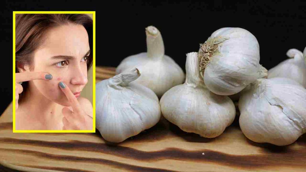 Garlic For Facial Beauty