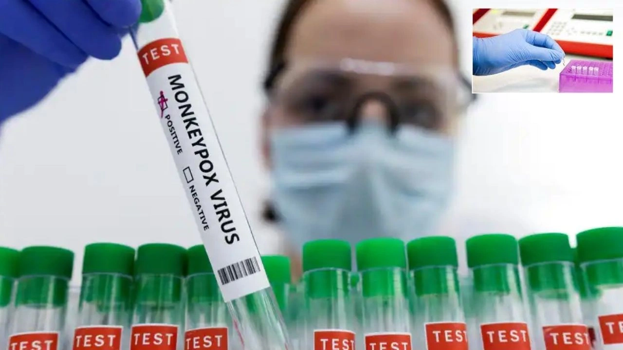 Monkeypox : మంకీపాక్స్ను గుర్తించేందుకు ఆర్టీ-పీసీఆర్ కిట్ Monkeypox : మంకీపాక్స్ను గుర్తించేందుకు ఆర్టీ-పీసీఆర్ కిట్