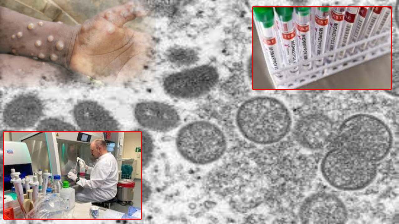 Monkeypox Virus : విజృంభిస్తున్న మంకీపాక్స్.. 14దేశాల్లో పాకిన వైరస్.. 100కిపైగా కేసులు..! Monkeypox Virus : విజృంభిస్తున్న మంకీపాక్స్.. 14దేశాల్లో పాకిన వైరస్.. 100కిపైగా కేసులు..!