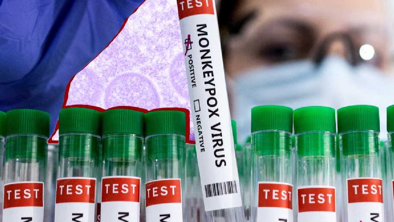 Monkeypox : మంకీపాక్స్ సోకిన వారు మూడు వారాలు వీటికి దూరంగా ఉండాలి Monkeypox : మంకీపాక్స్ సోకిన వారు మూడు వారాలు వీటికి దూరంగా ఉండాలి