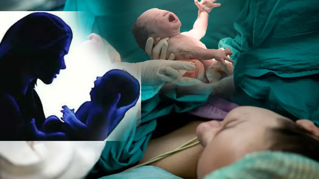 Pregnants Caesarean Section After Seeing A Good Moment