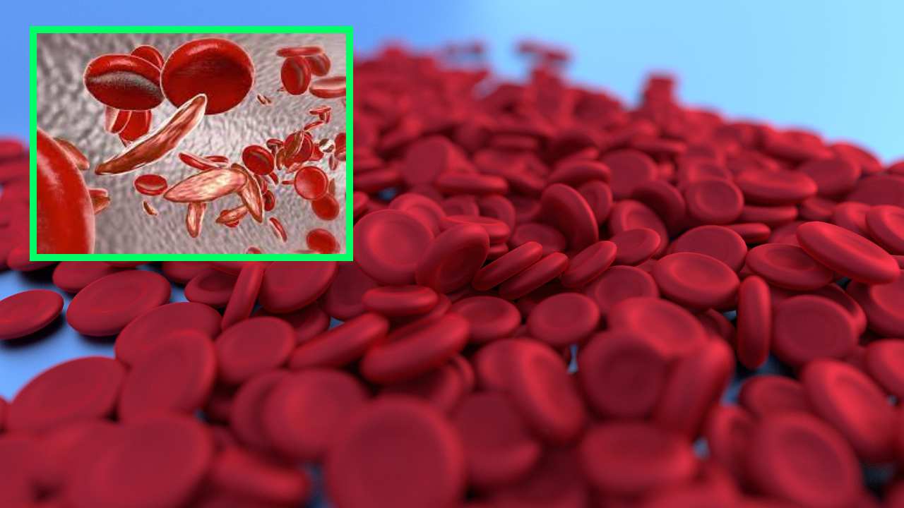 Hemoglobin : రక్తంలో హిమోగ్లోబిన్ శాతం తగ్గిందా? Hemoglobin : రక్తంలో హిమోగ్లోబిన్ శాతం తగ్గిందా?