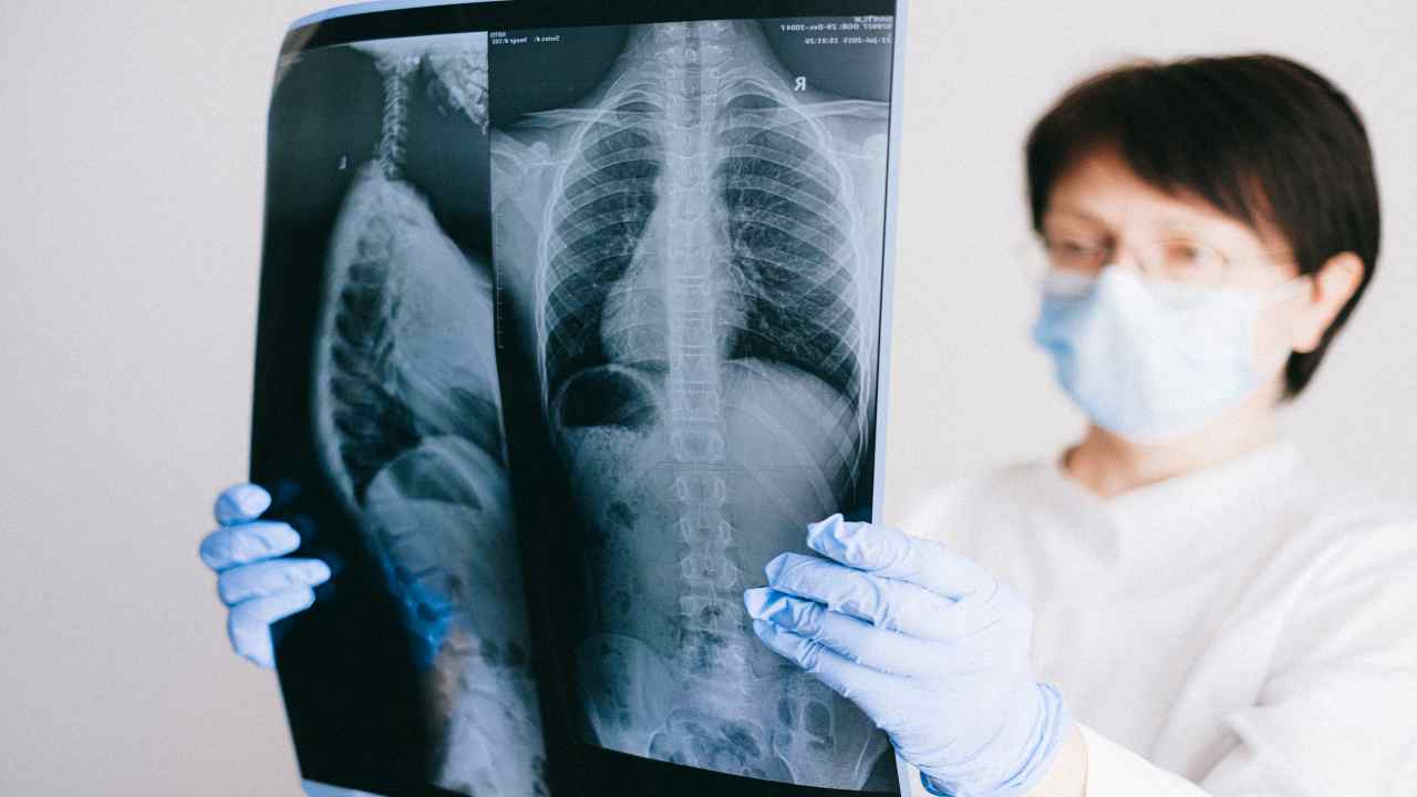 Lungs : ఊపిరితిత్తుల్లో నీరు ప్రాణాంతకమా? Lungs : ఊపిరితిత్తుల్లో నీరు ప్రాణాంతకమా?
